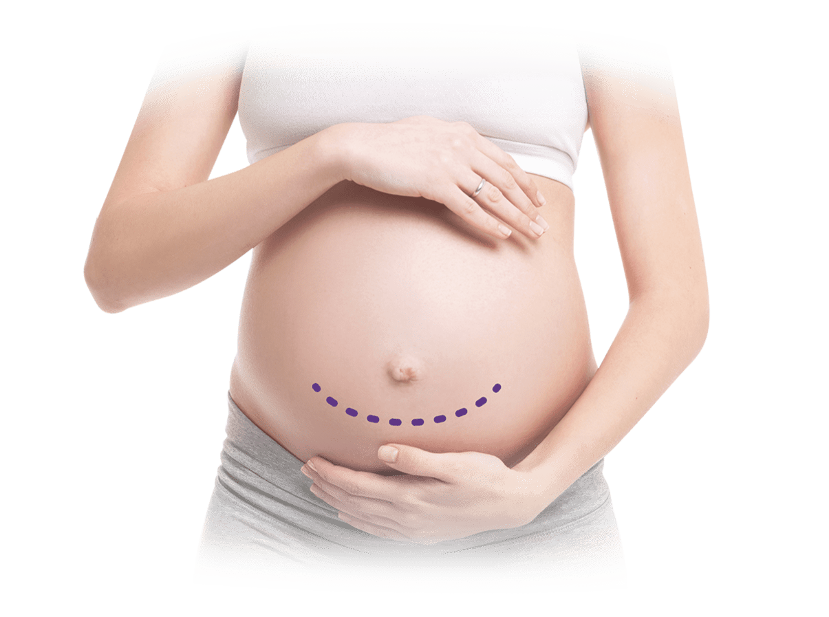 การดูแลสุขภาพช่วงตั้งครรภ์